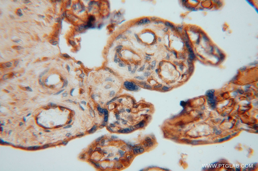 Immunohistochemistry (IHC) staining of human placenta tissue using JIP2 Polyclonal antibody (13912-1-AP)
