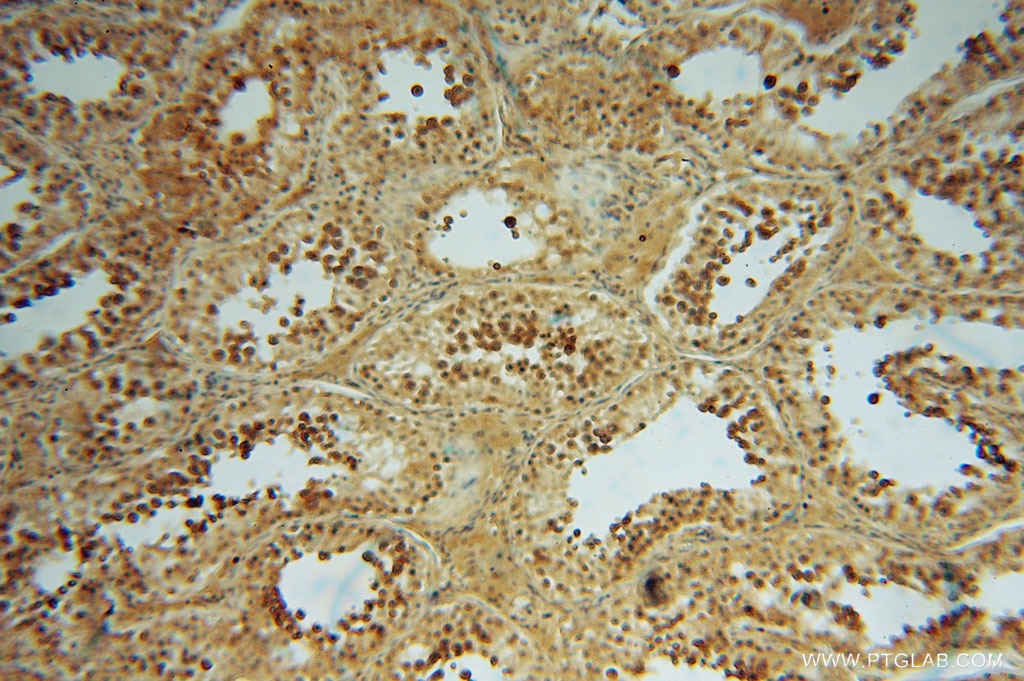 Immunohistochemistry (IHC) staining of human testis tissue using JIP2 Polyclonal antibody (13912-1-AP)