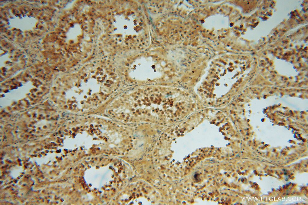 IHC staining of human testis using 13912-1-AP