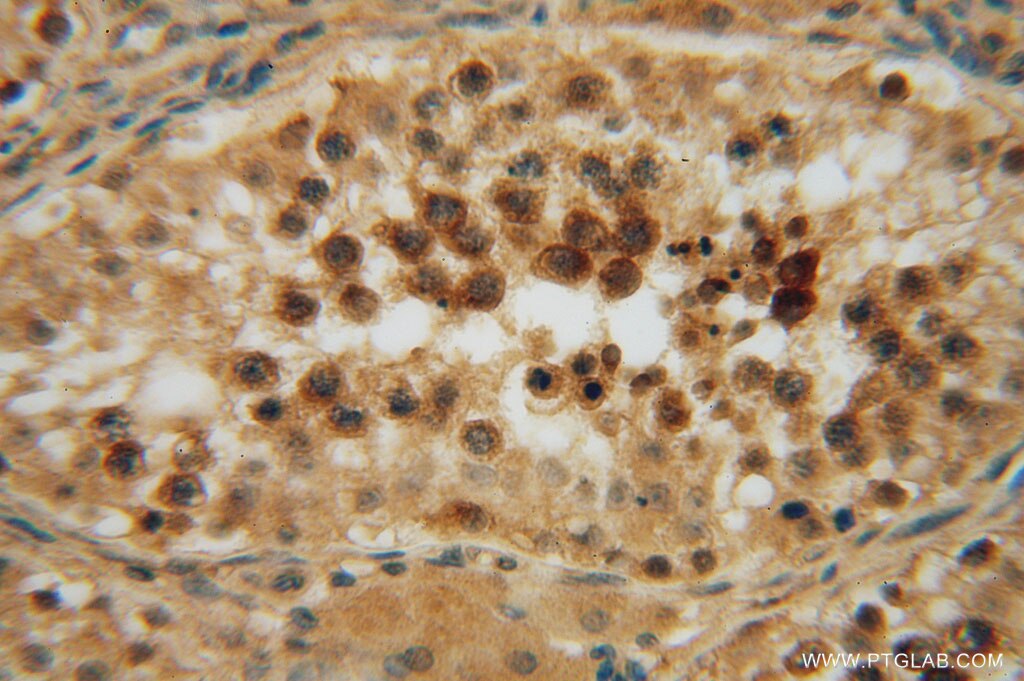 Immunohistochemistry (IHC) staining of human testis tissue using JIP2 Polyclonal antibody (13912-1-AP)