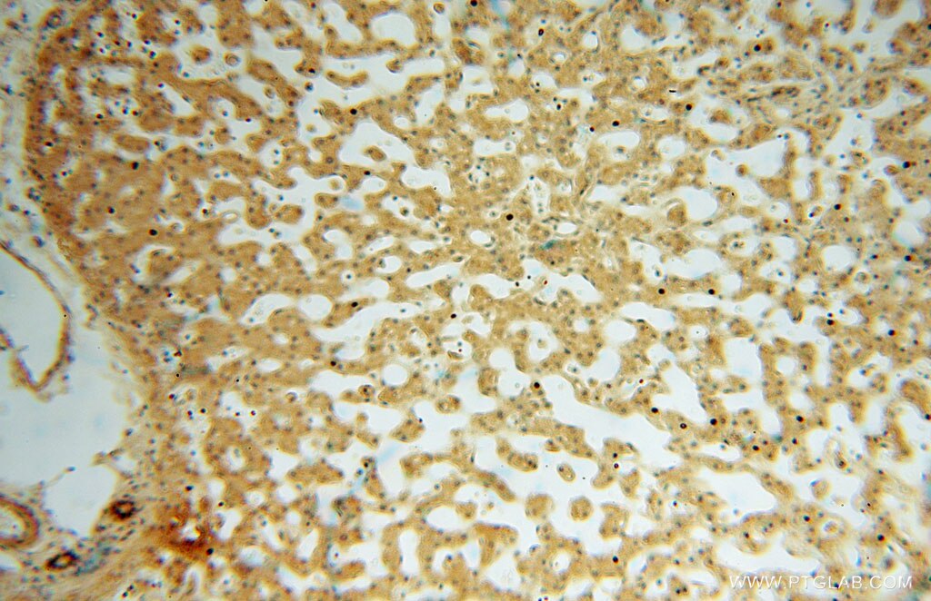 Immunohistochemistry (IHC) staining of human liver tissue using JIP2 Polyclonal antibody (13912-1-AP)