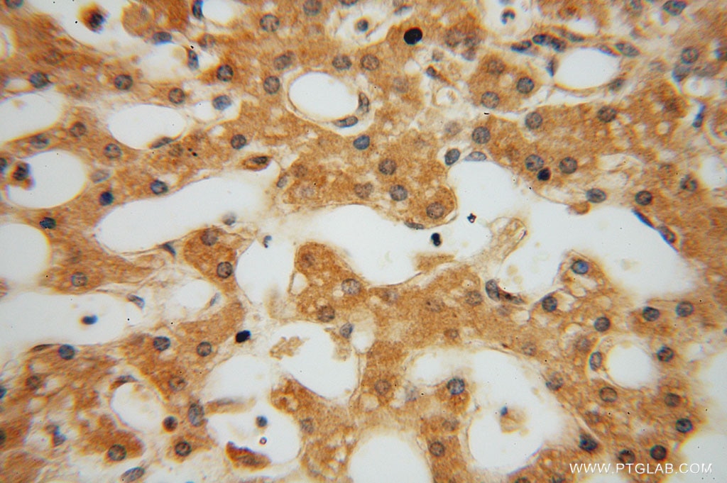 Immunohistochemistry (IHC) staining of human liver tissue using JIP2 Polyclonal antibody (13912-1-AP)
