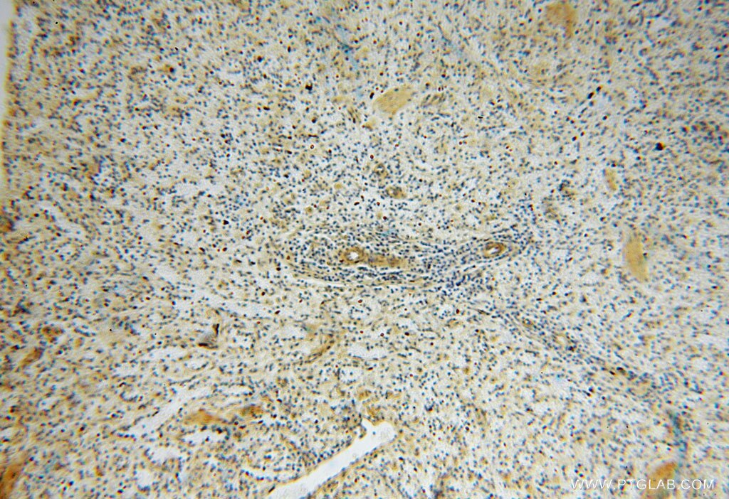 Immunohistochemistry (IHC) staining of human spleen tissue using JIP2 Polyclonal antibody (13912-1-AP)