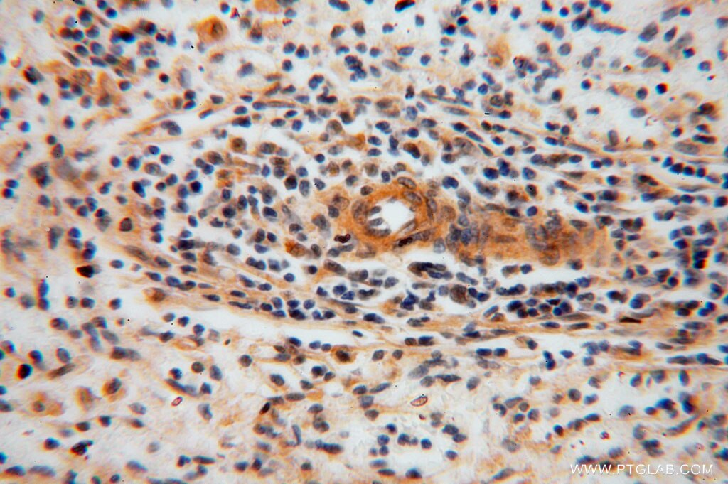 Immunohistochemistry (IHC) staining of human spleen tissue using JIP2 Polyclonal antibody (13912-1-AP)