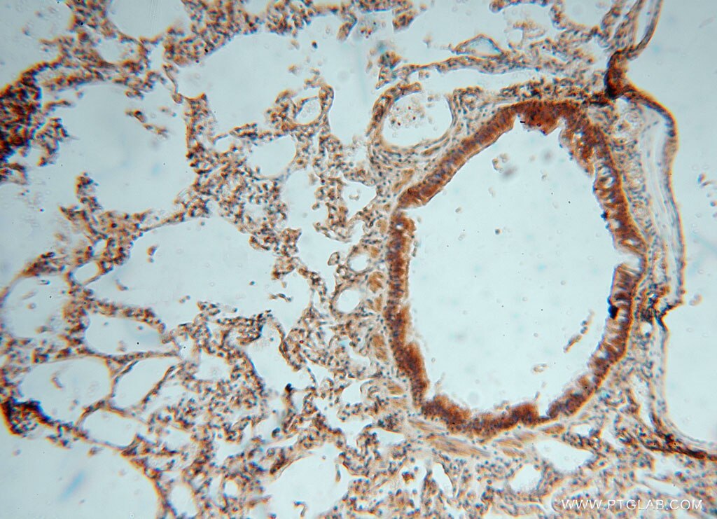 Immunohistochemistry (IHC) staining of human lung tissue using JIP2 Polyclonal antibody (13912-1-AP)