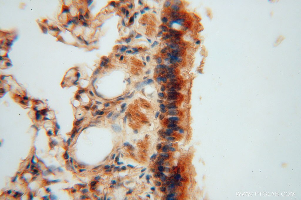 Immunohistochemistry (IHC) staining of human lung tissue using JIP2 Polyclonal antibody (13912-1-AP)