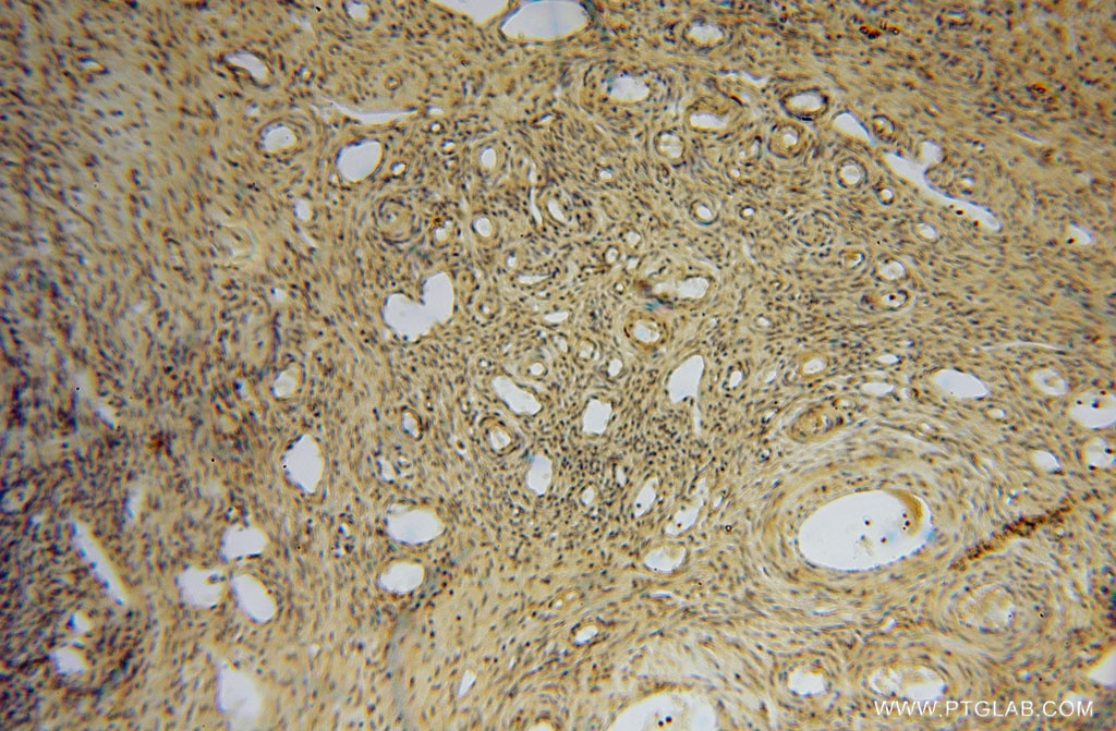 Immunohistochemistry (IHC) staining of human ovary tissue using JIP2 Polyclonal antibody (13912-1-AP)