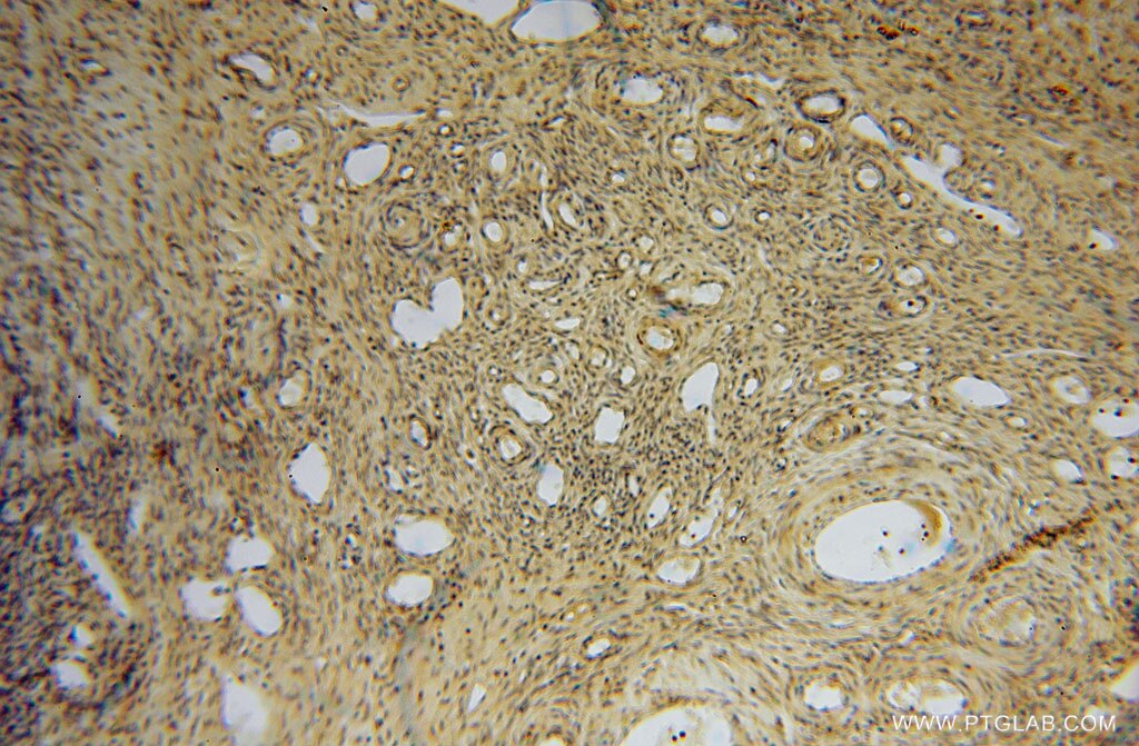 IHC staining of human ovary using 13912-1-AP