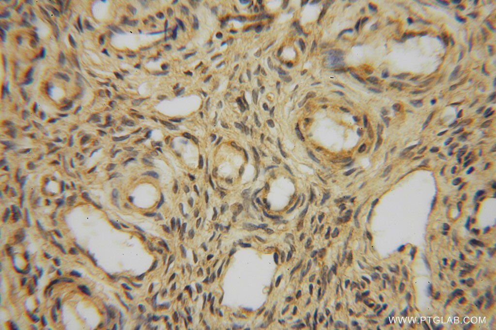 IHC staining of human ovary using 13912-1-AP