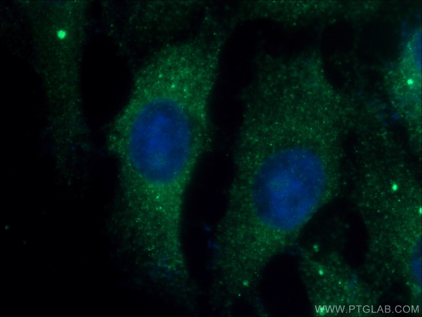 Immunofluorescence (IF) / fluorescent staining of SH-SY5Y cells using JNK Polyclonal antibody (17337-1-AP)