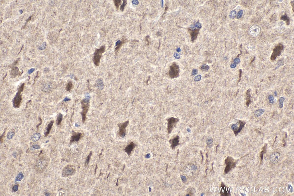 Immunohistochemical analysis of paraffin-embedded rat brain tissue slide using 17337-1-AP (JNK antibody) at dilution of 1:500 (under 40x lens). Heat mediated antigen retrieval with Tris-EDTA buffer (pH 9.0). Immunohistochemistry (IHC) staining of rat brain tissue using JNK Polyclonal antibody (17337-1-AP)