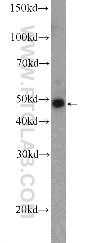 Western Blot (WB) analysis of mouse brain tissue using JNK Polyclonal antibody (17337-1-AP)