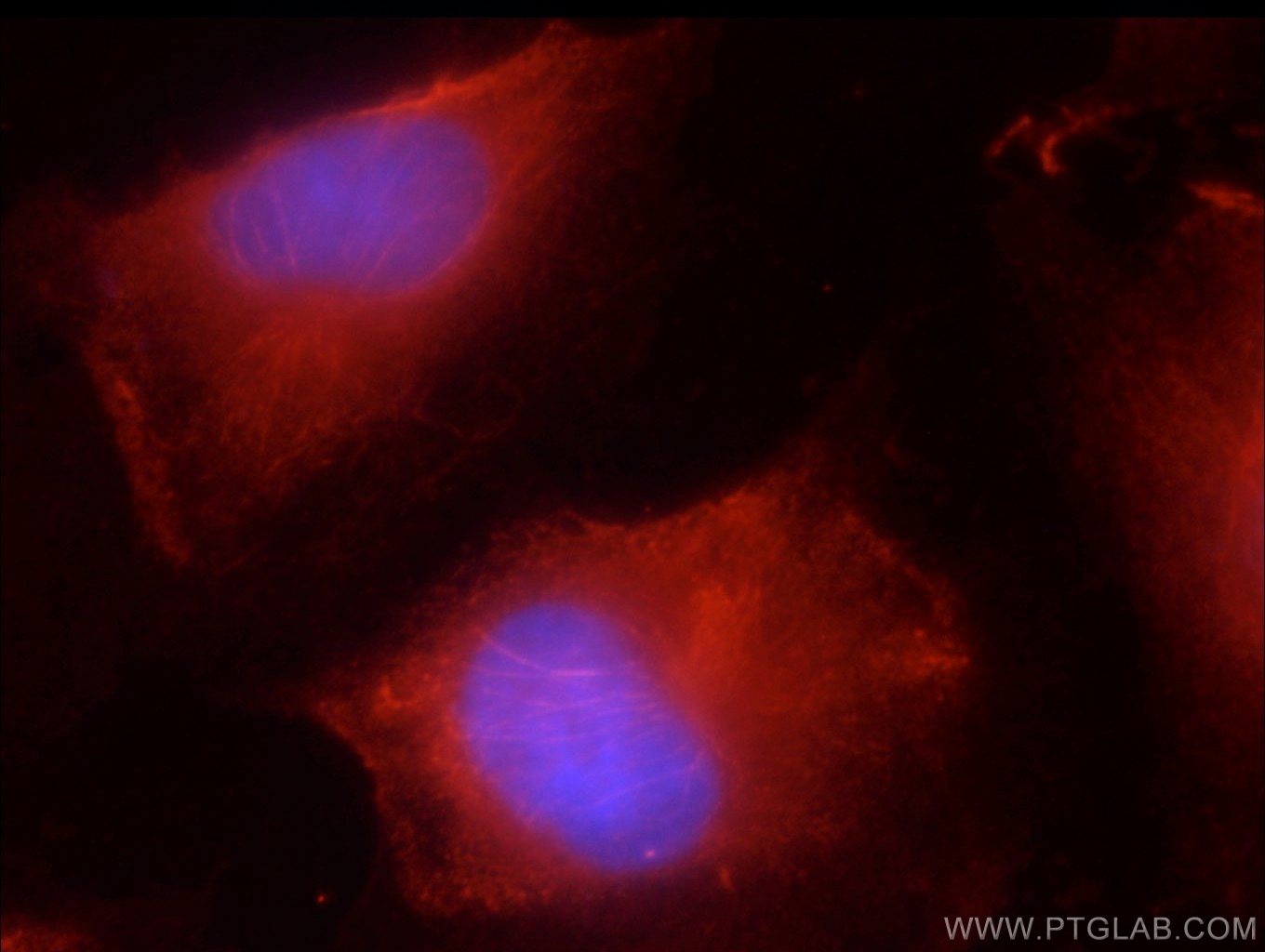 Immunofluorescence (IF) / fluorescent staining of HUVEC cells using JNK Polyclonal antibody (51153-1-AP)