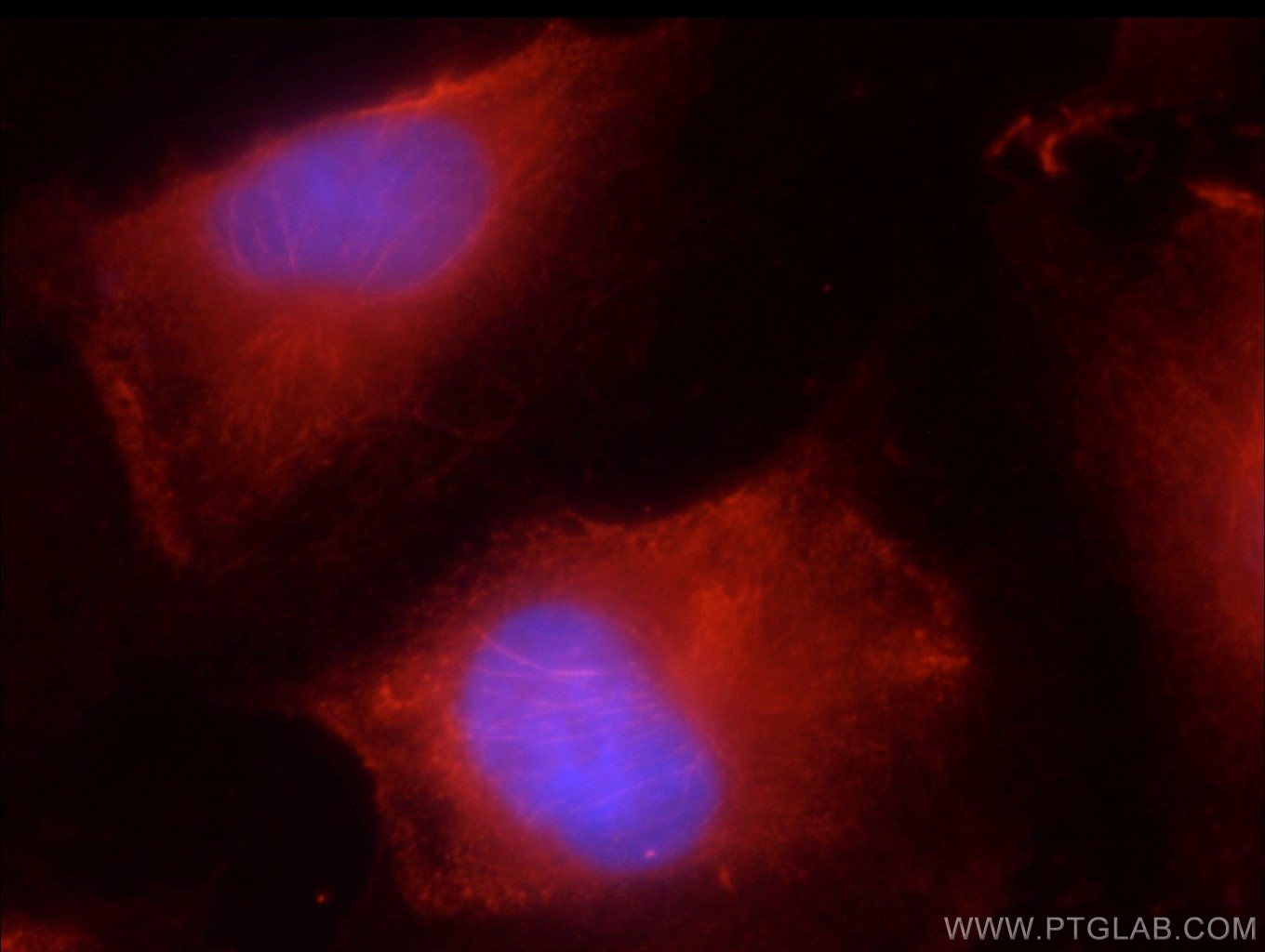 IF Staining of HUVEC using 51153-1-AP