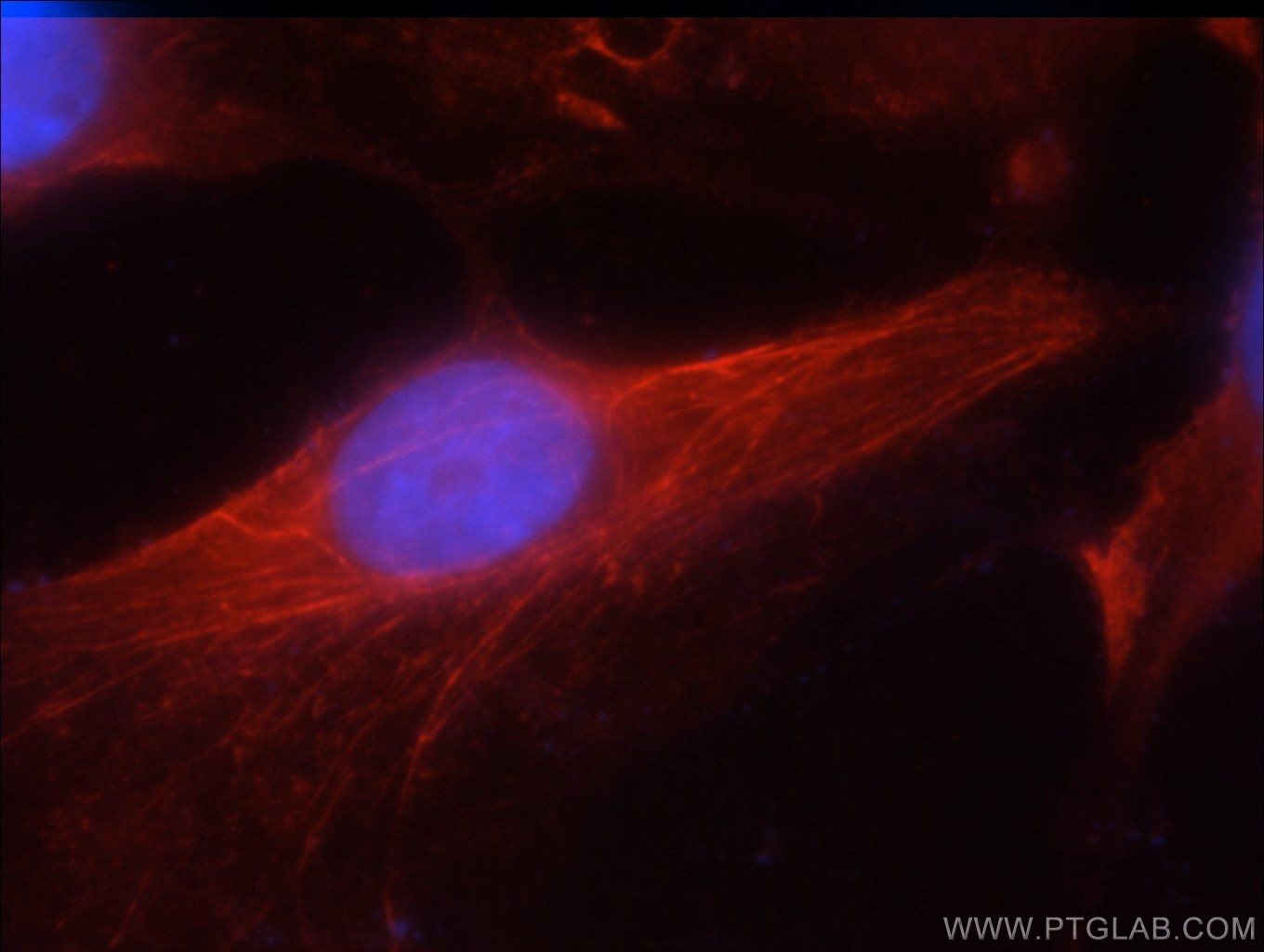 Immunofluorescence (IF) / fluorescent staining of HeLa cells using JNK Polyclonal antibody (51153-1-AP)