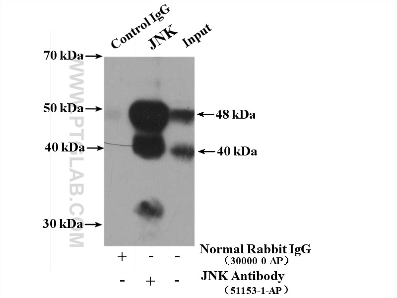 Immunoprecipitation (IP) experiment of HeLa cells using JNK1/2/3 Polyclonal antibody (51153-1-AP)
