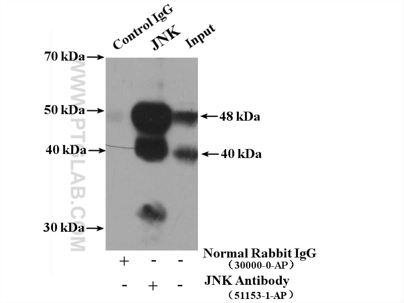 IP experiment of HeLa using 51153-1-AP