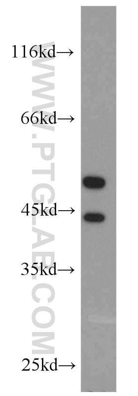 Western Blot (WB) analysis of HeLa cells using JNK Polyclonal antibody (51153-1-AP)