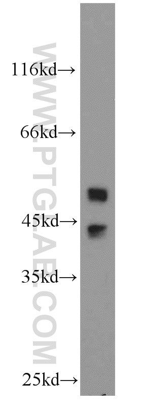 Western Blot (WB) analysis of A549 cells using JNK Polyclonal antibody (51153-1-AP)