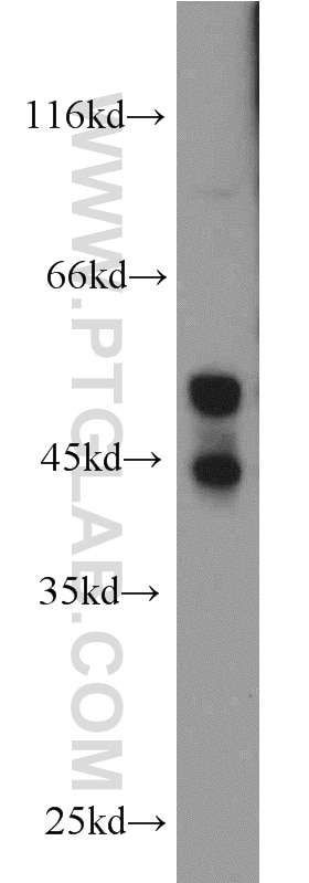 Western Blot (WB) analysis of NIH/3T3 cells using JNK1/2/3 Polyclonal antibody (51153-1-AP)