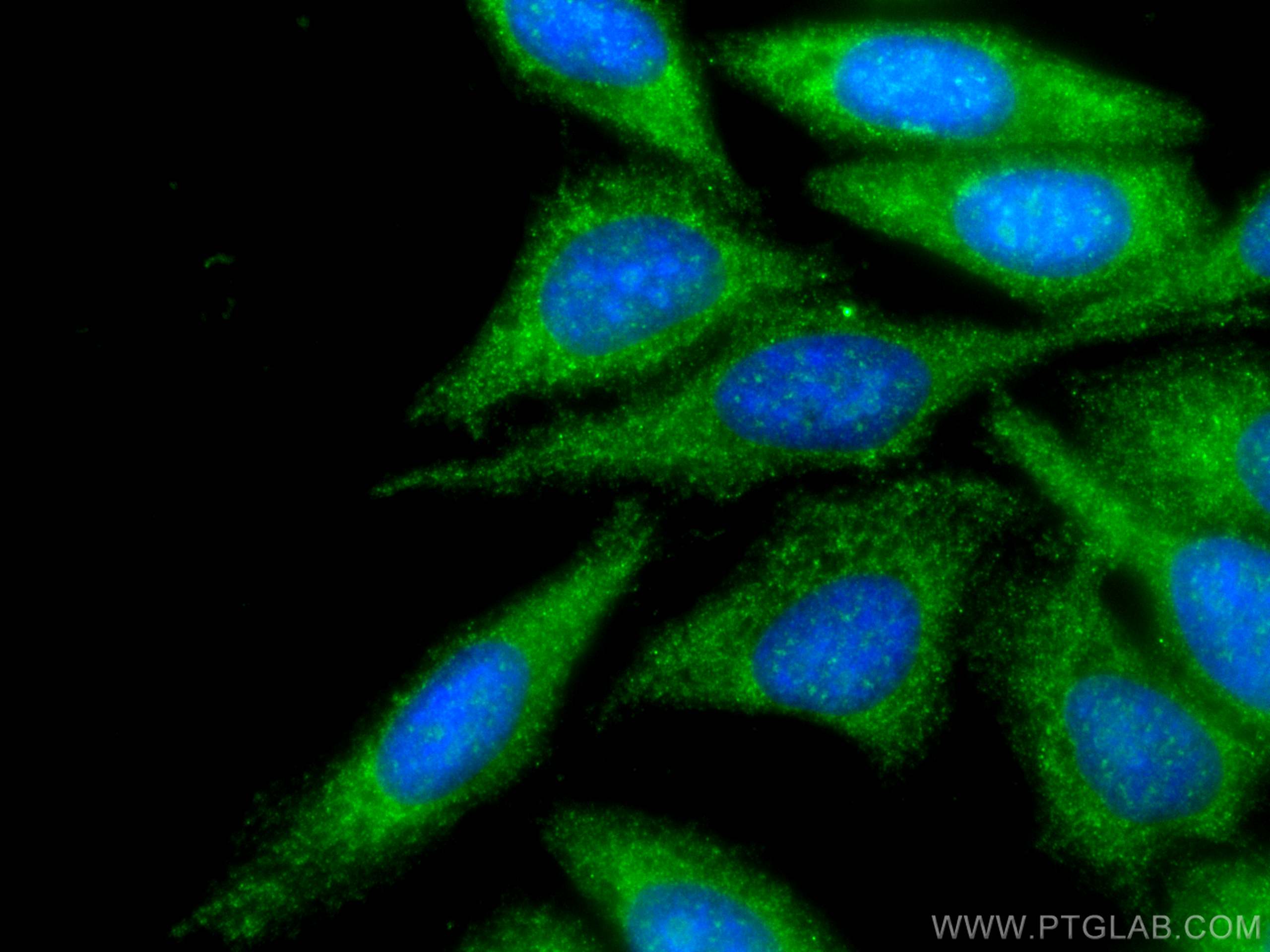 Immunofluorescence (IF) / fluorescent staining of HepG2 cells using SIN1 Polyclonal antibody (15463-1-AP)