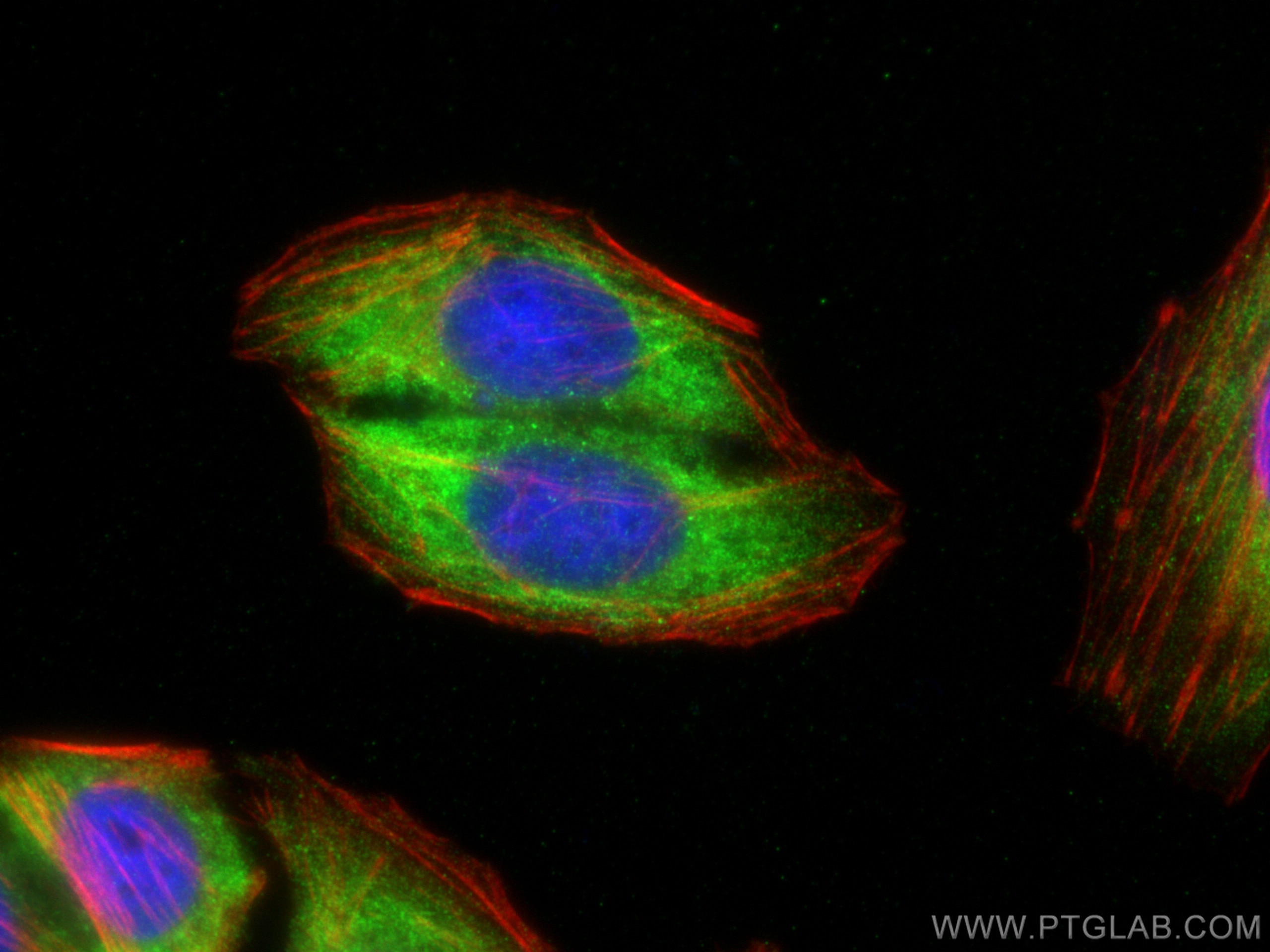 Immunofluorescence (IF) / fluorescent staining of HepG2 cells using SIN1/MAPKAP1 Polyclonal antibody (15463-1-AP)