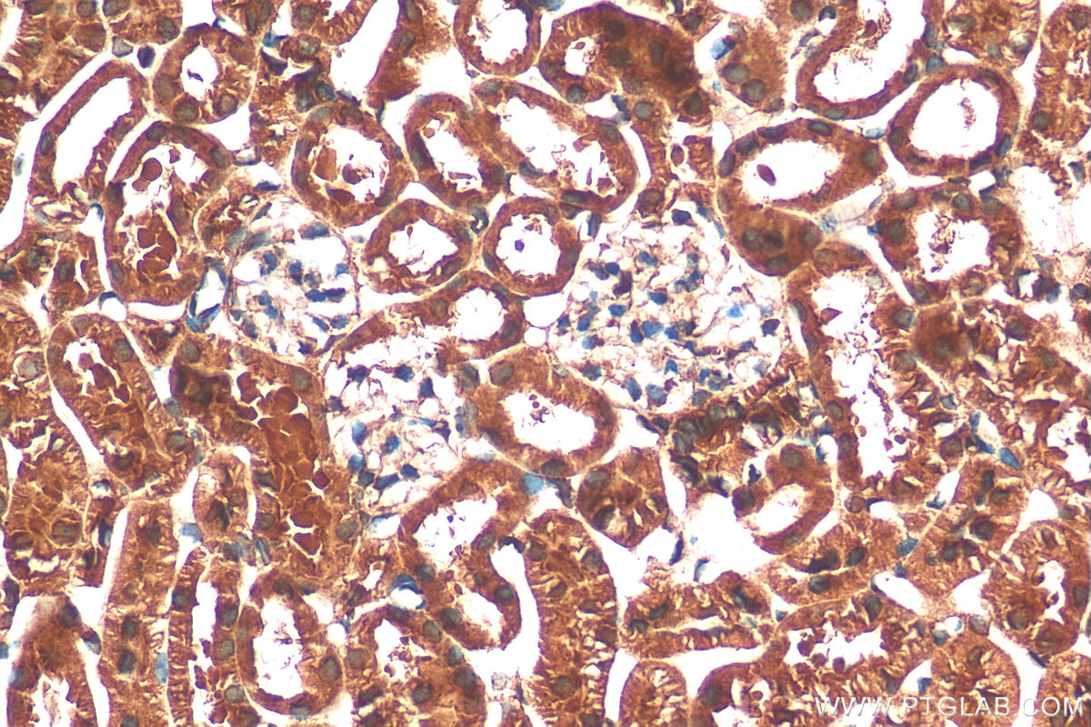 Immunohistochemistry (IHC) staining of mouse kidney tissue using SIN1 Polyclonal antibody (15463-1-AP)