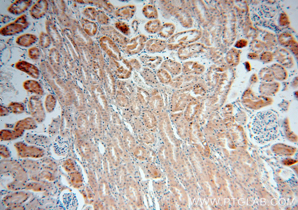 Immunohistochemistry (IHC) staining of human kidney tissue using SIN1 Polyclonal antibody (15463-1-AP)