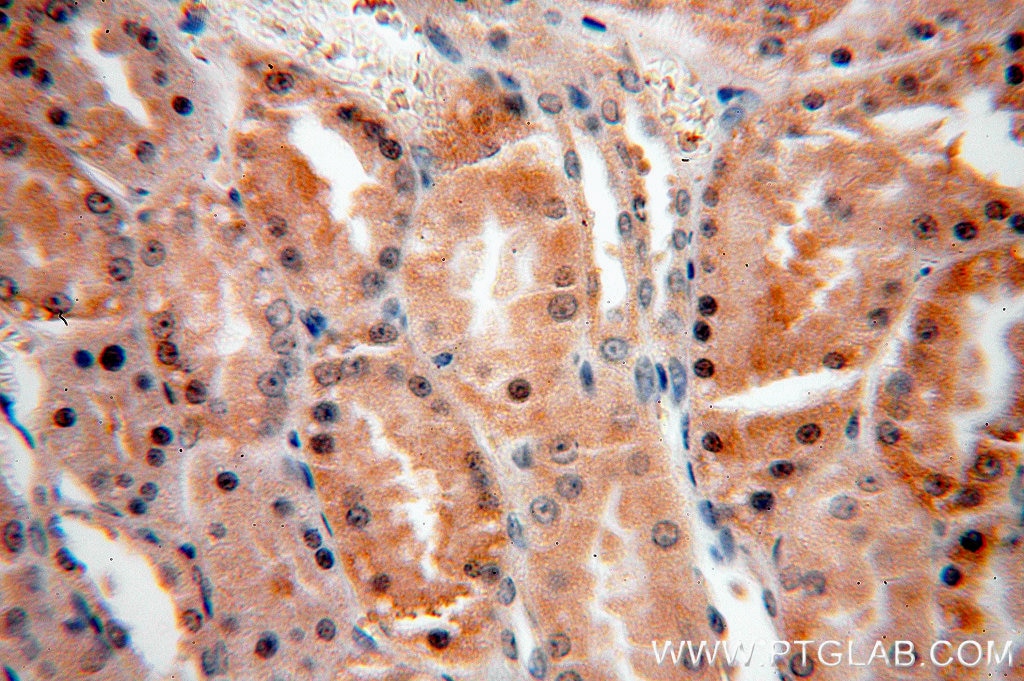 Immunohistochemistry (IHC) staining of human kidney tissue using SIN1 Polyclonal antibody (15463-1-AP)