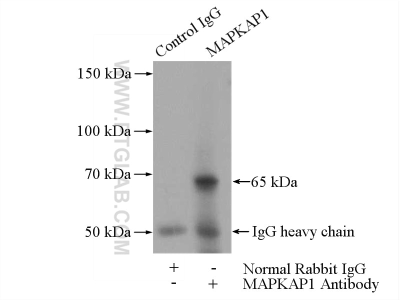 Immunoprecipitation (IP) experiment of mouse kidney tissue using SIN1 Polyclonal antibody (15463-1-AP)