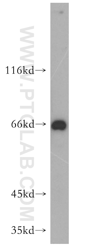 Western Blot (WB) analysis of mouse kidney tissue using SIN1 Polyclonal antibody (15463-1-AP)