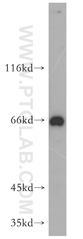 WB analysis of mouse kidney using 15463-1-AP