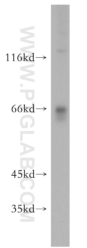 Western Blot (WB) analysis of HeLa cells using SIN1 Polyclonal antibody (15463-1-AP)