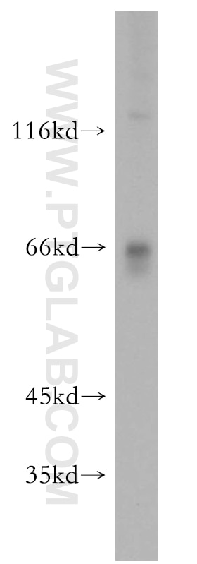 WB analysis of HeLa using 15463-1-AP