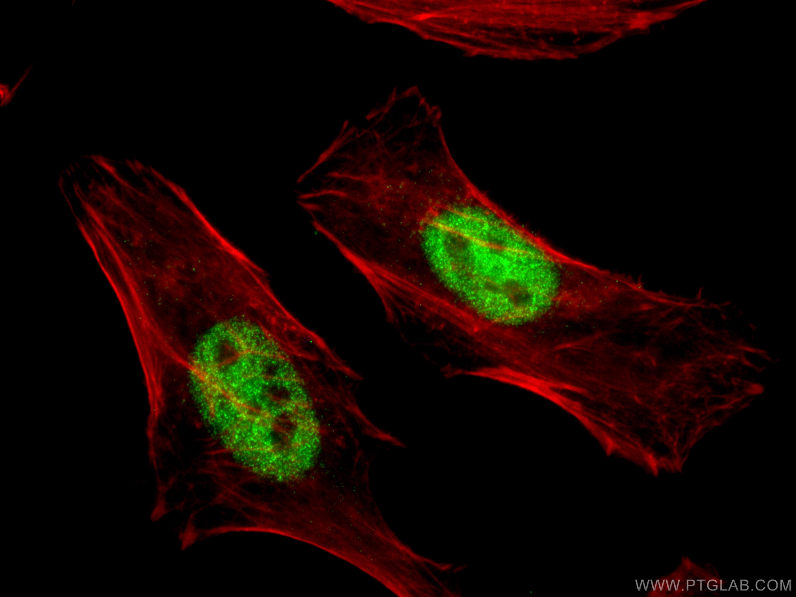 Immunofluorescence (IF) / fluorescent staining of HeLa cells using MAPKAPK2 Polyclonal antibody (13949-1-AP)