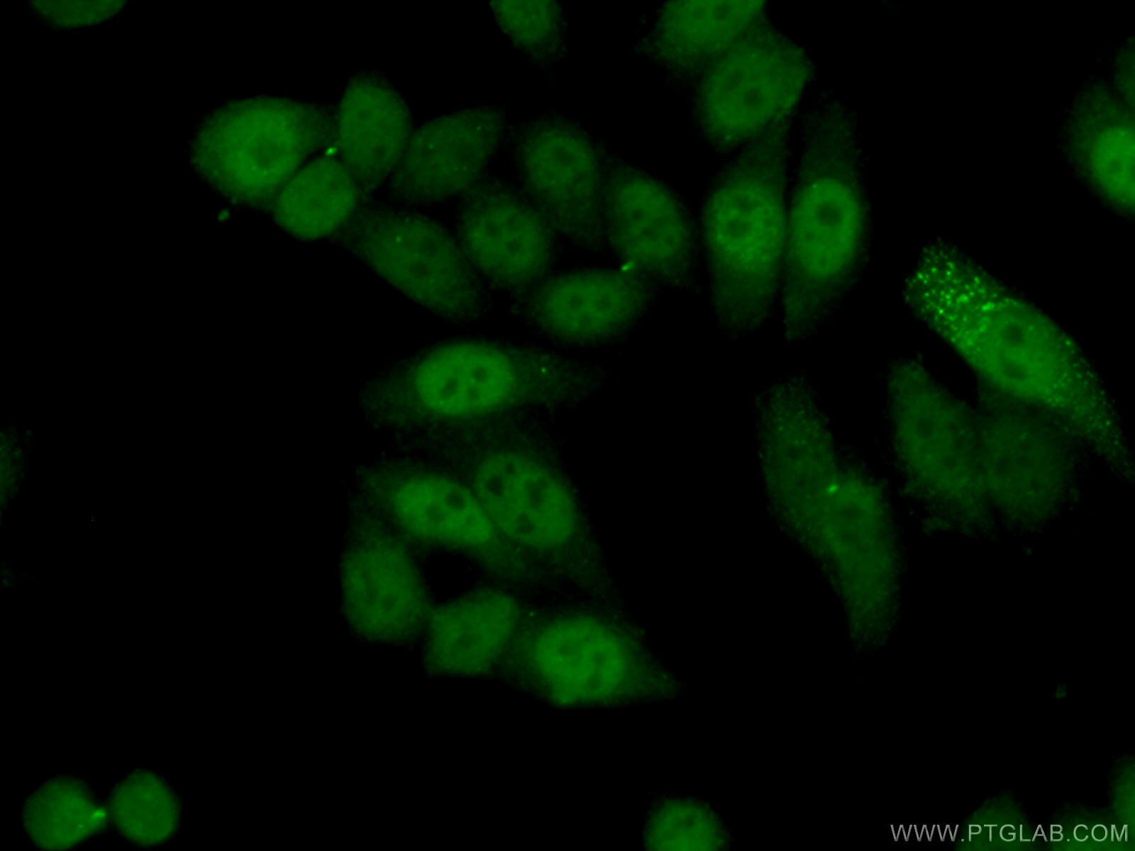 Immunofluorescence (IF) / fluorescent staining of HeLa cells using MAPKAPK2 Polyclonal antibody (13949-1-AP)