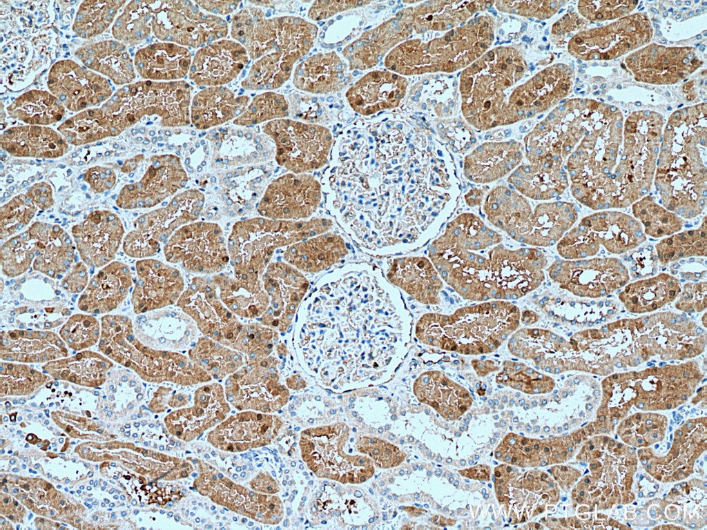 Immunohistochemistry (IHC) staining of human kidney tissue using MAPKAPK2 Polyclonal antibody (13949-1-AP)