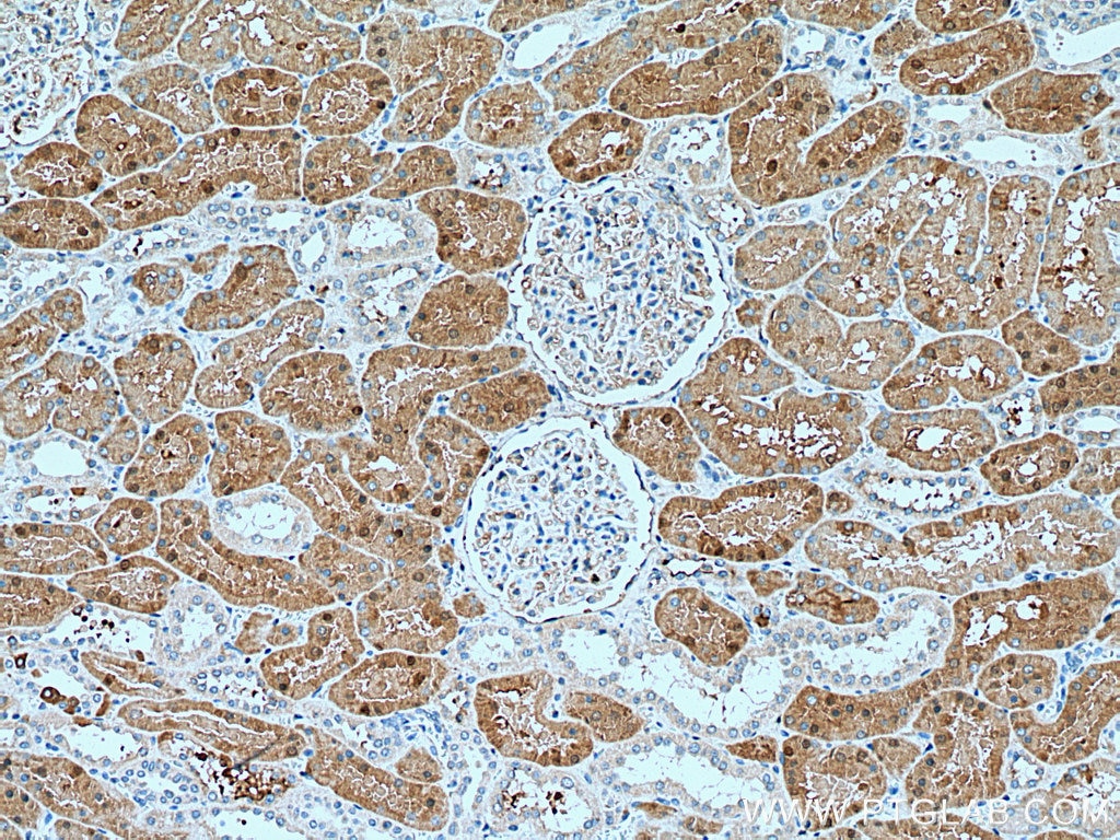 IHC staining of human kidney using 13949-1-AP