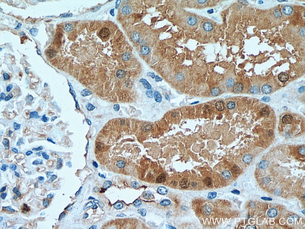 Immunohistochemistry (IHC) staining of human kidney tissue using MAPKAPK2 Polyclonal antibody (13949-1-AP)