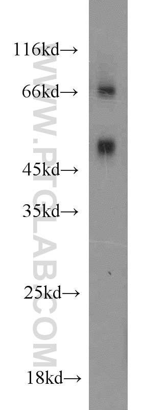 MAPKAPK2 Polyclonal antibody