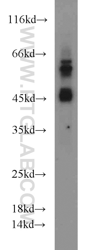 Western Blot (WB) analysis of A549 cells using MAPKAPK2 Polyclonal antibody (13949-1-AP)