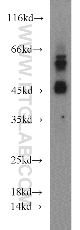 WB analysis of A549 using 13949-1-AP