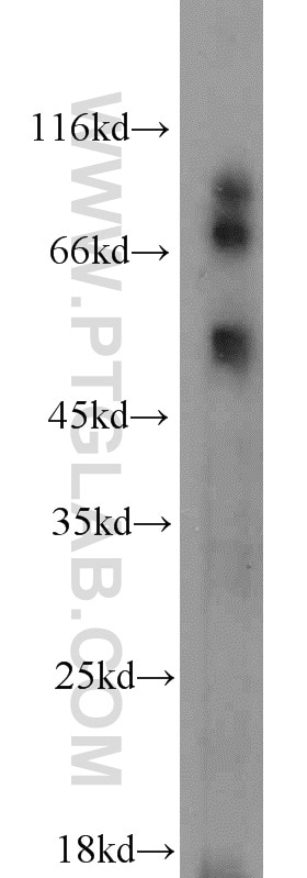 Western Blot (WB) analysis of mouse skeletal muscle tissue using MAPKAPK2 Polyclonal antibody (13949-1-AP)