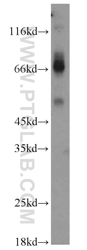 Western Blot (WB) analysis of mouse colon tissue using MAPKAPK2 Polyclonal antibody (13949-1-AP)
