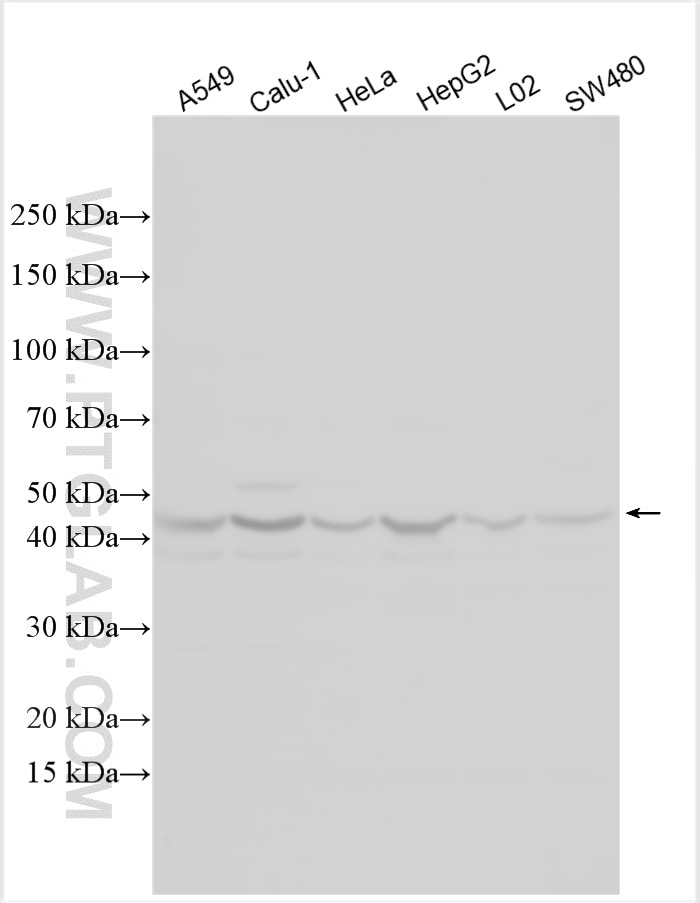 WB analysis using 30841-1-AP Western Blot (WB) analysis of various lysates using MAPKAPK2 Polyclonal antibody (30841-1-AP)