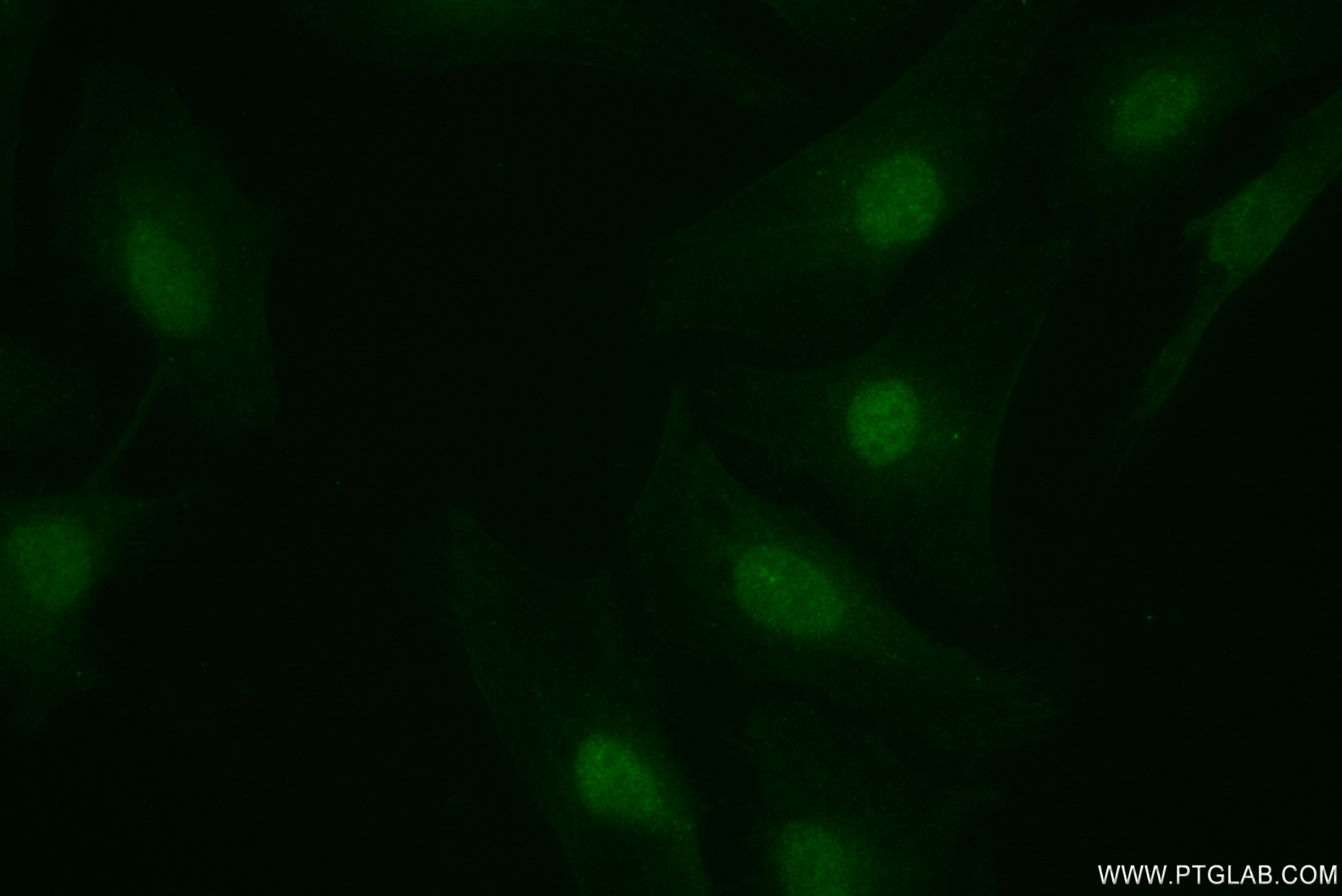 Immunofluorescence (IF) / fluorescent staining of HeLa cells using MAPKAPK2 Recombinant antibody (82929-1-RR)