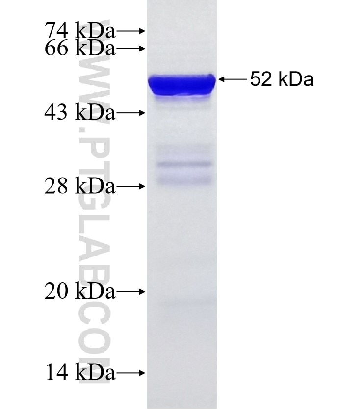 MAPKAPK2 fusion protein Ag16027 SDS-PAGE