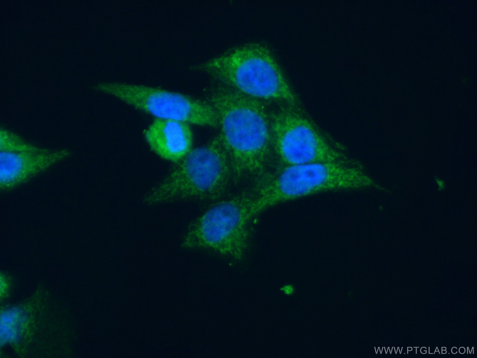 Immunofluorescence (IF) / fluorescent staining of HeLa cells using MAPKAPK3 Polyclonal antibody (15424-1-AP)