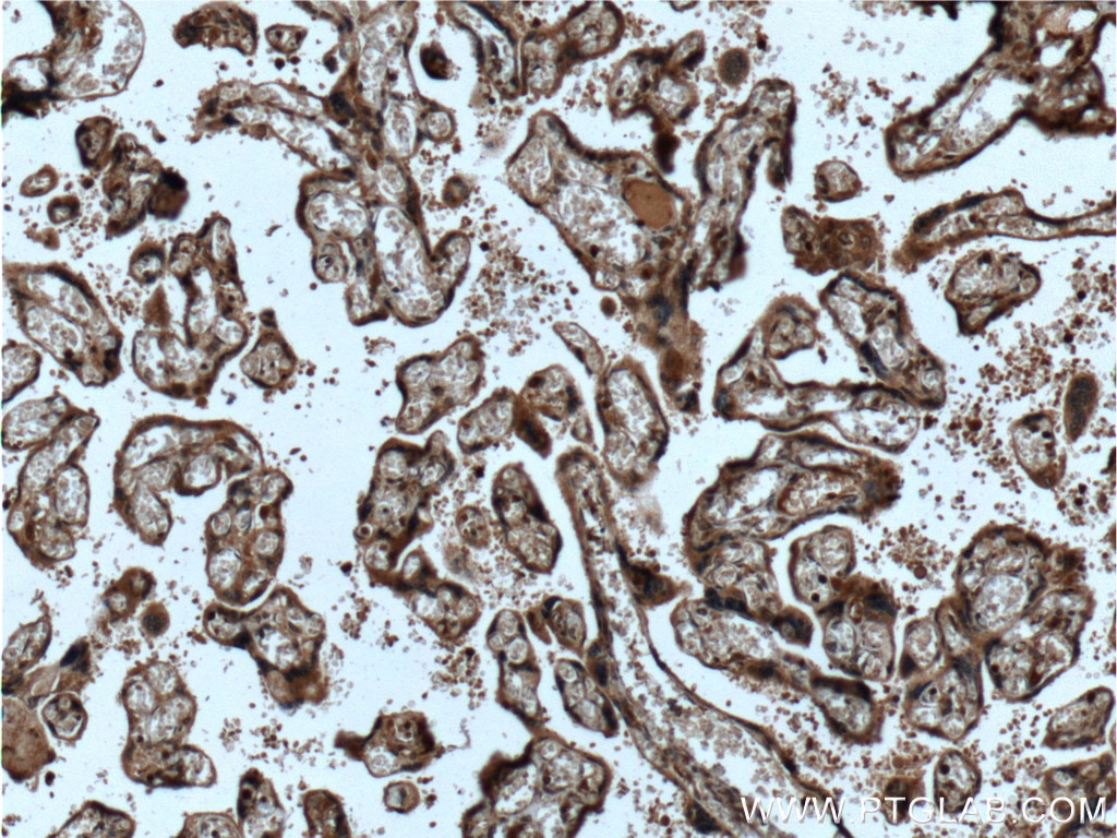 Immunohistochemistry (IHC) staining of human placenta tissue using MAPKAPK3 Polyclonal antibody (15424-1-AP)