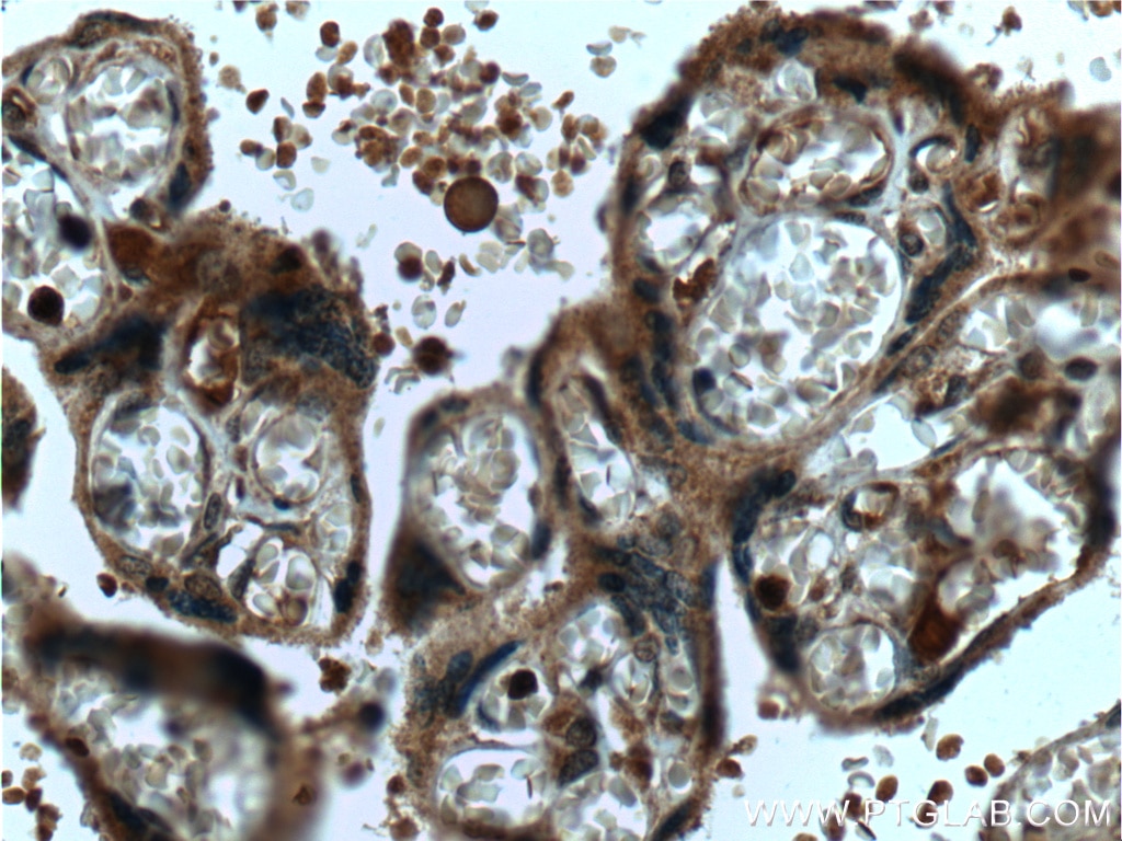 Immunohistochemistry (IHC) staining of human placenta tissue using MAPKAPK3 Polyclonal antibody (15424-1-AP)